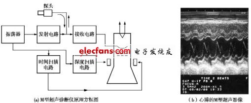 第4节 典型超声影像设备的工作原理简述