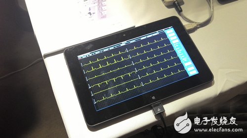 MEMRS electrocardiographic and electrophysiological examination network system