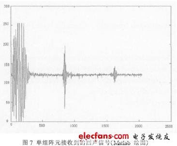 B型超声射频