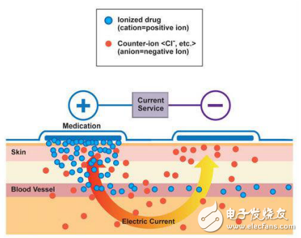 另一种基于MCU的给药设备