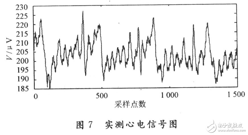 心电监护仪怎么看波形图片